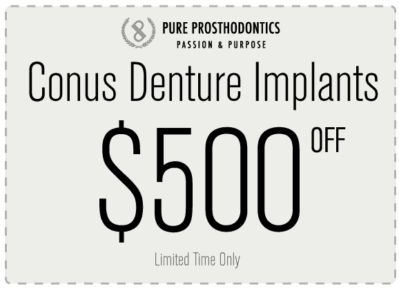 Conus Denture Implant Procedure Houston - Cost and Coupon